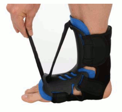 Night Splints Products, Supplies and Equipment
