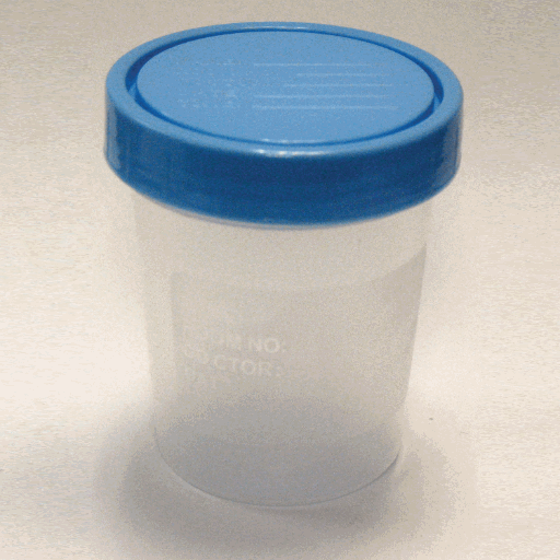 Specimen Collection Cups Products, Supplies and Equipment