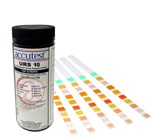 Point of Care Urinalysis Products, Supplies and Equipment